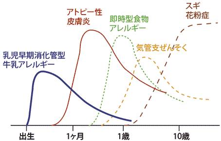 アレルギー | 小児科コラム | 秋山こどもクリニック