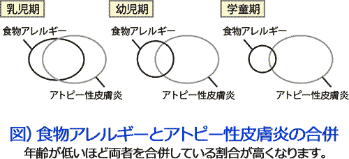 アレルギー | 小児科コラム | 秋山こどもクリニック